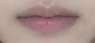 前