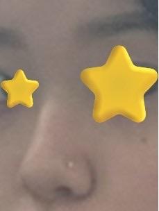 後