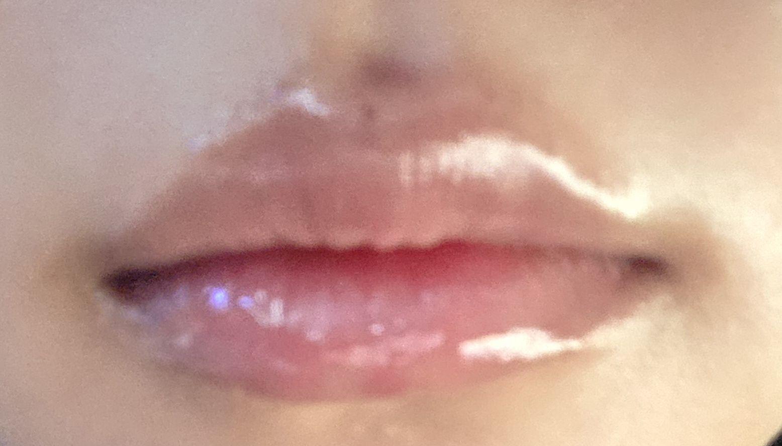后