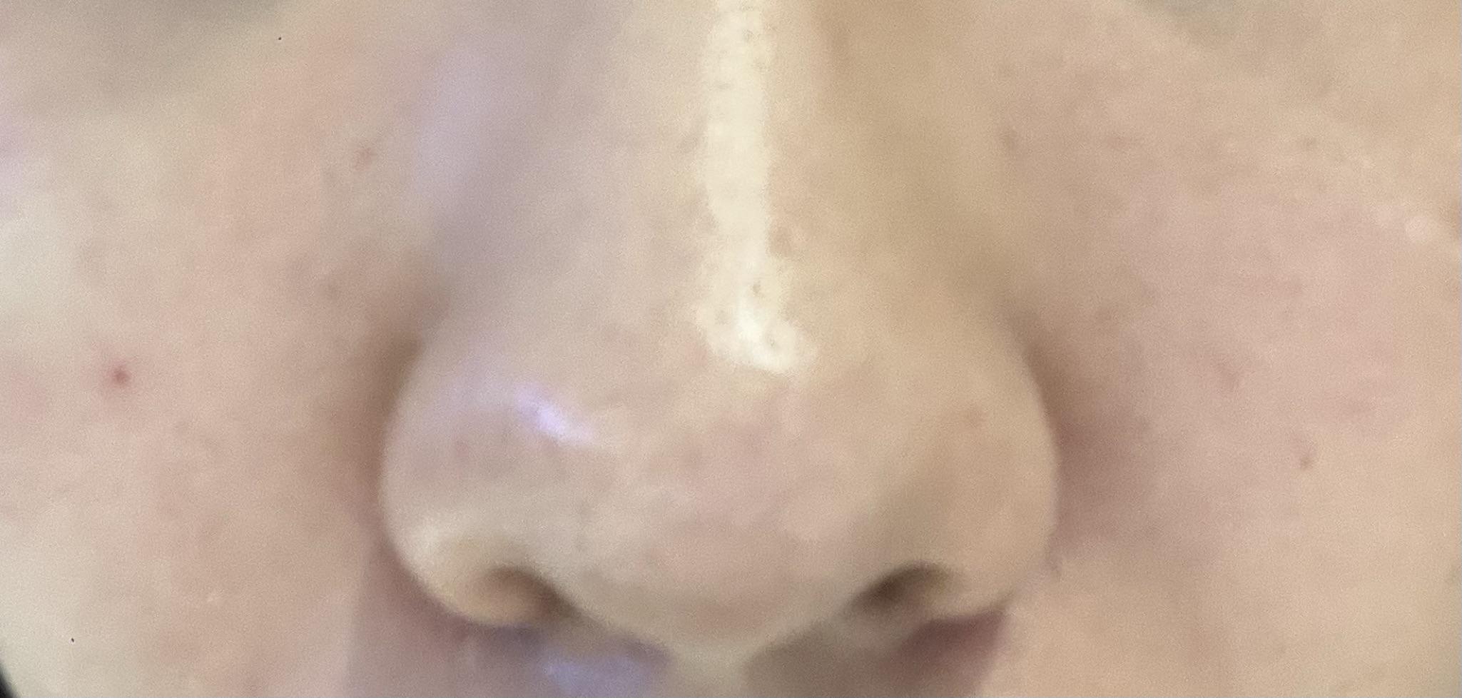 後