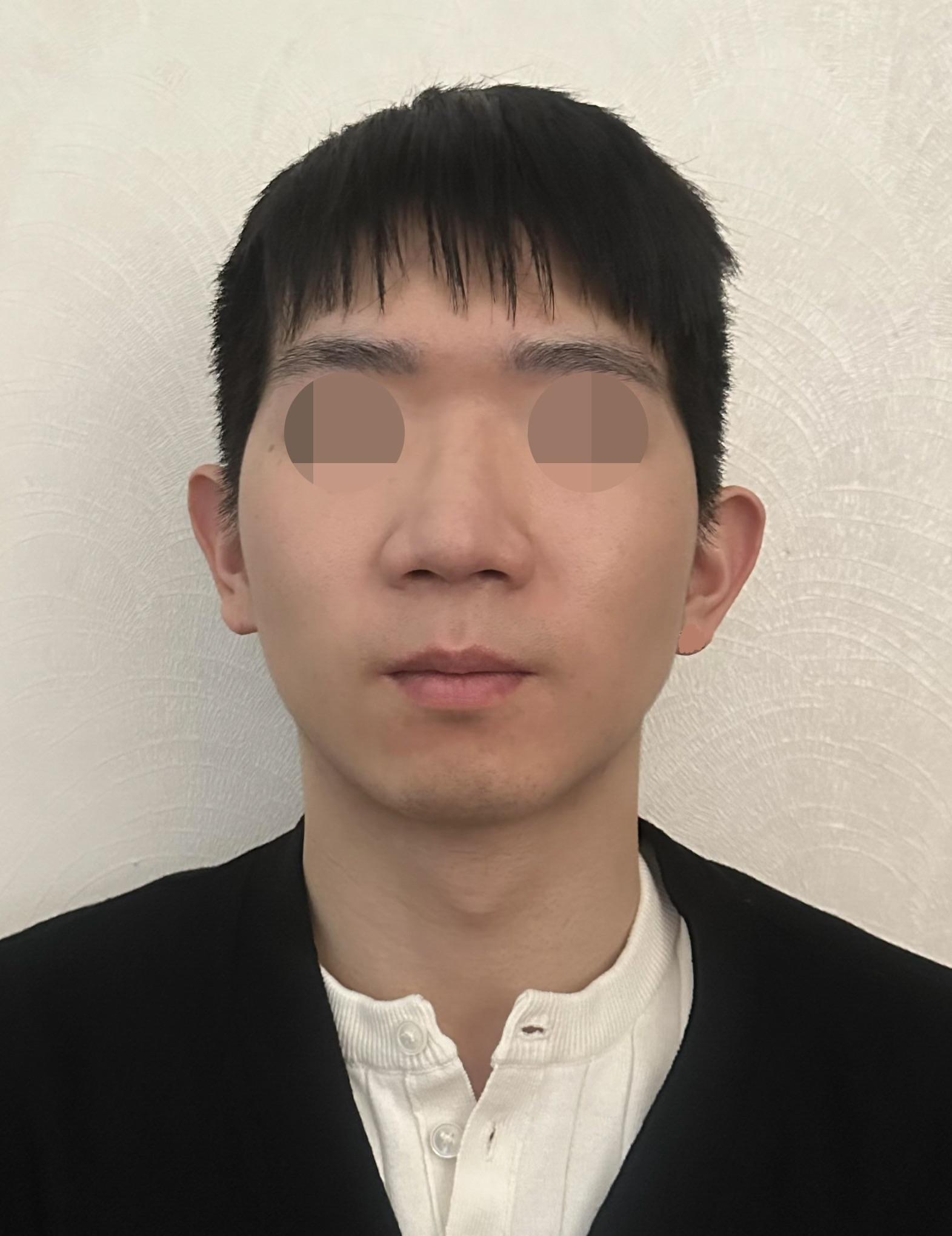 後