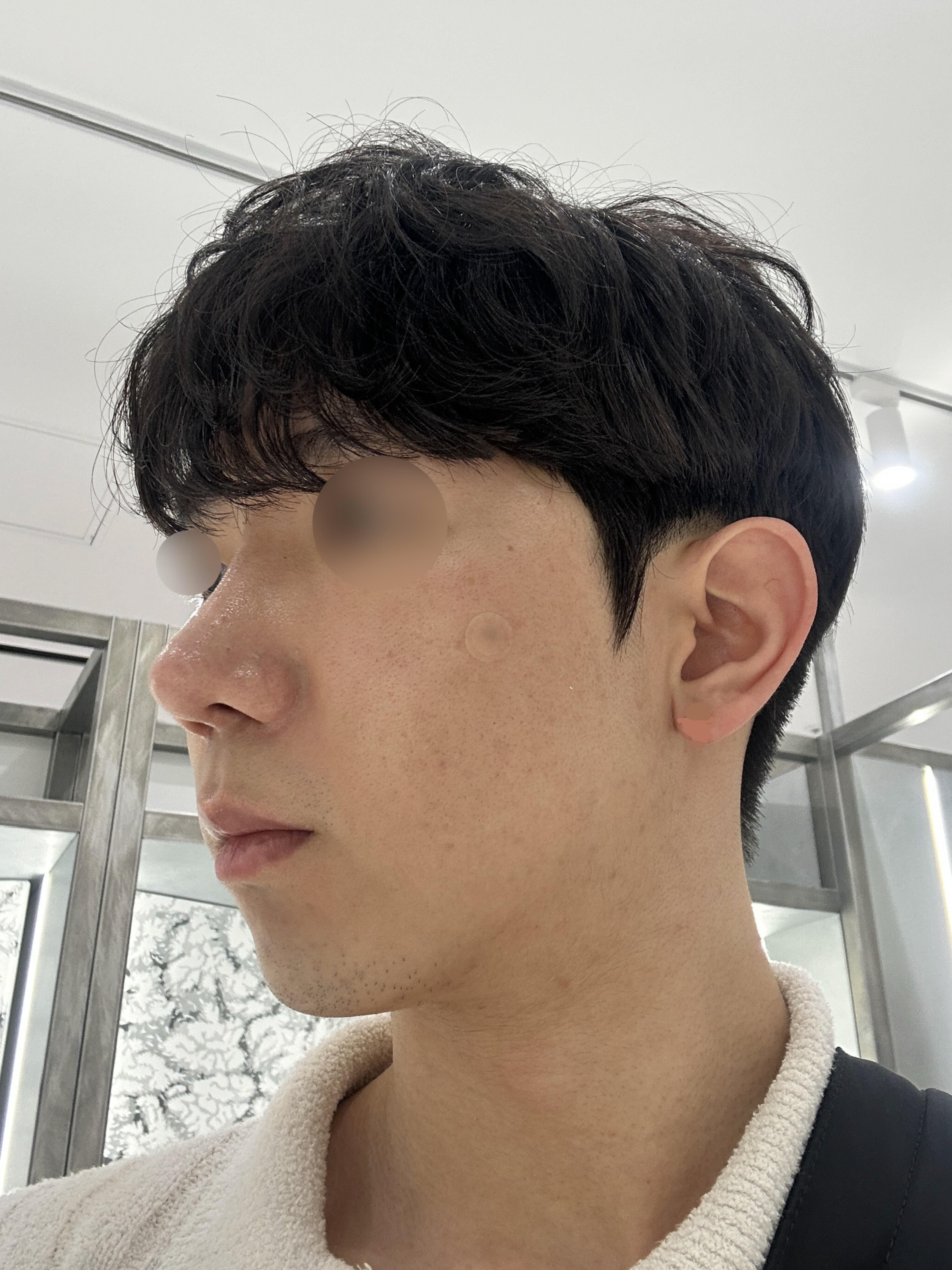 後