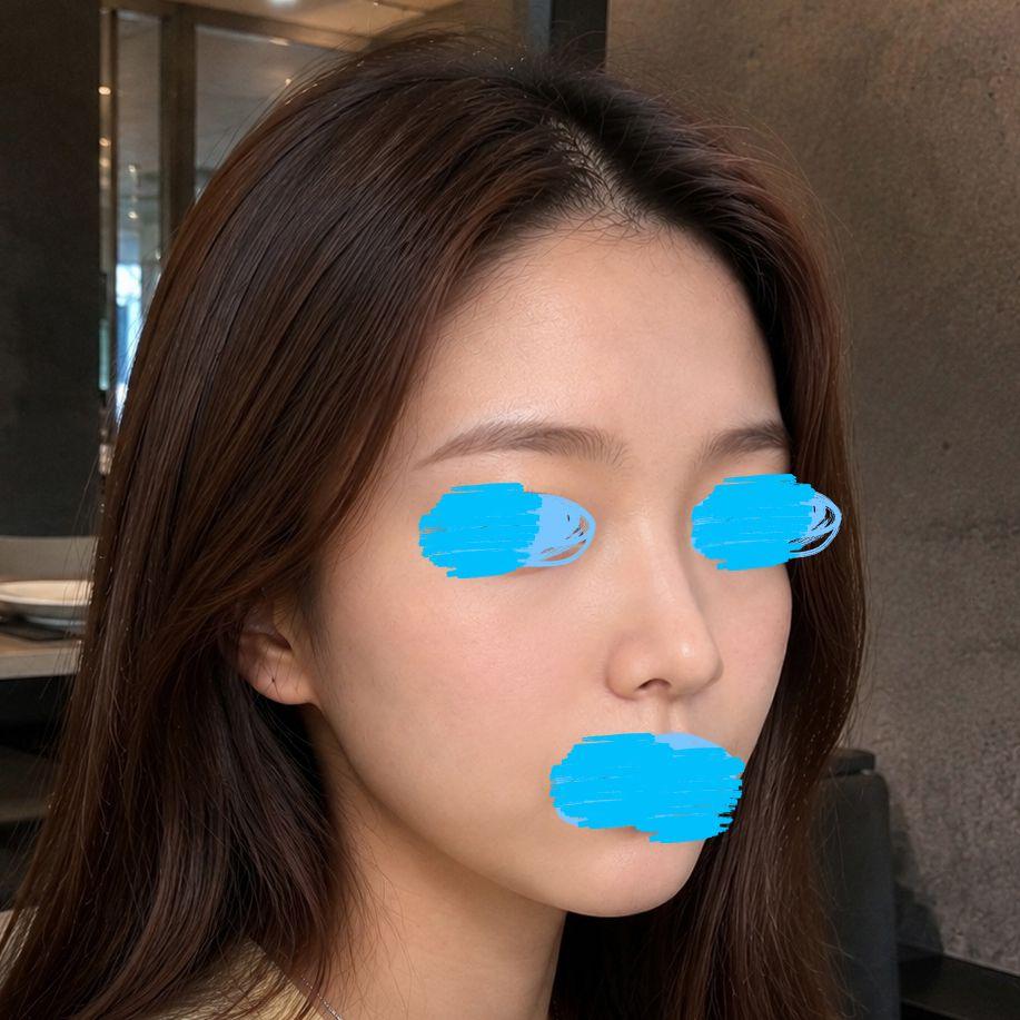 後