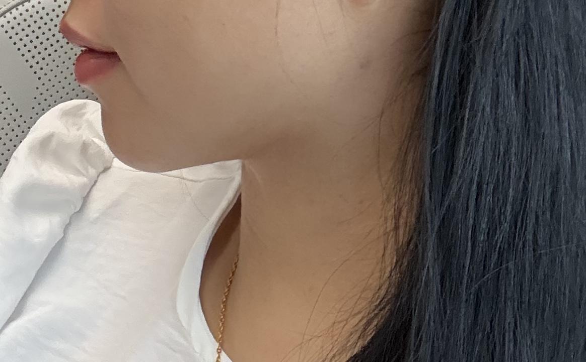 後