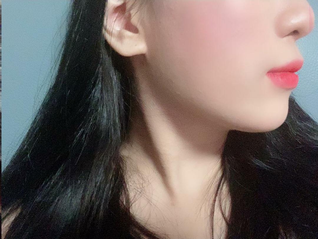 後