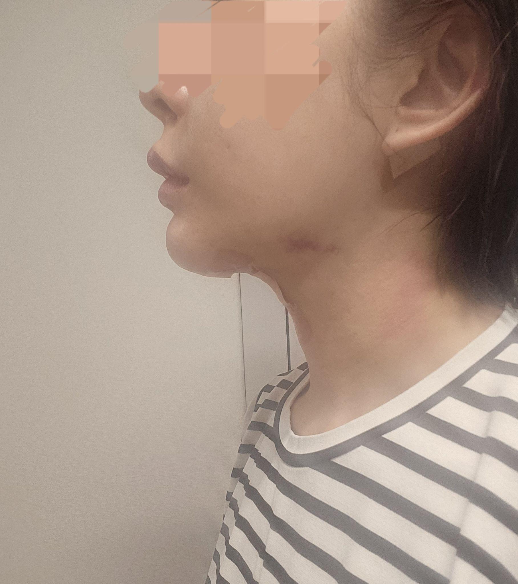 後