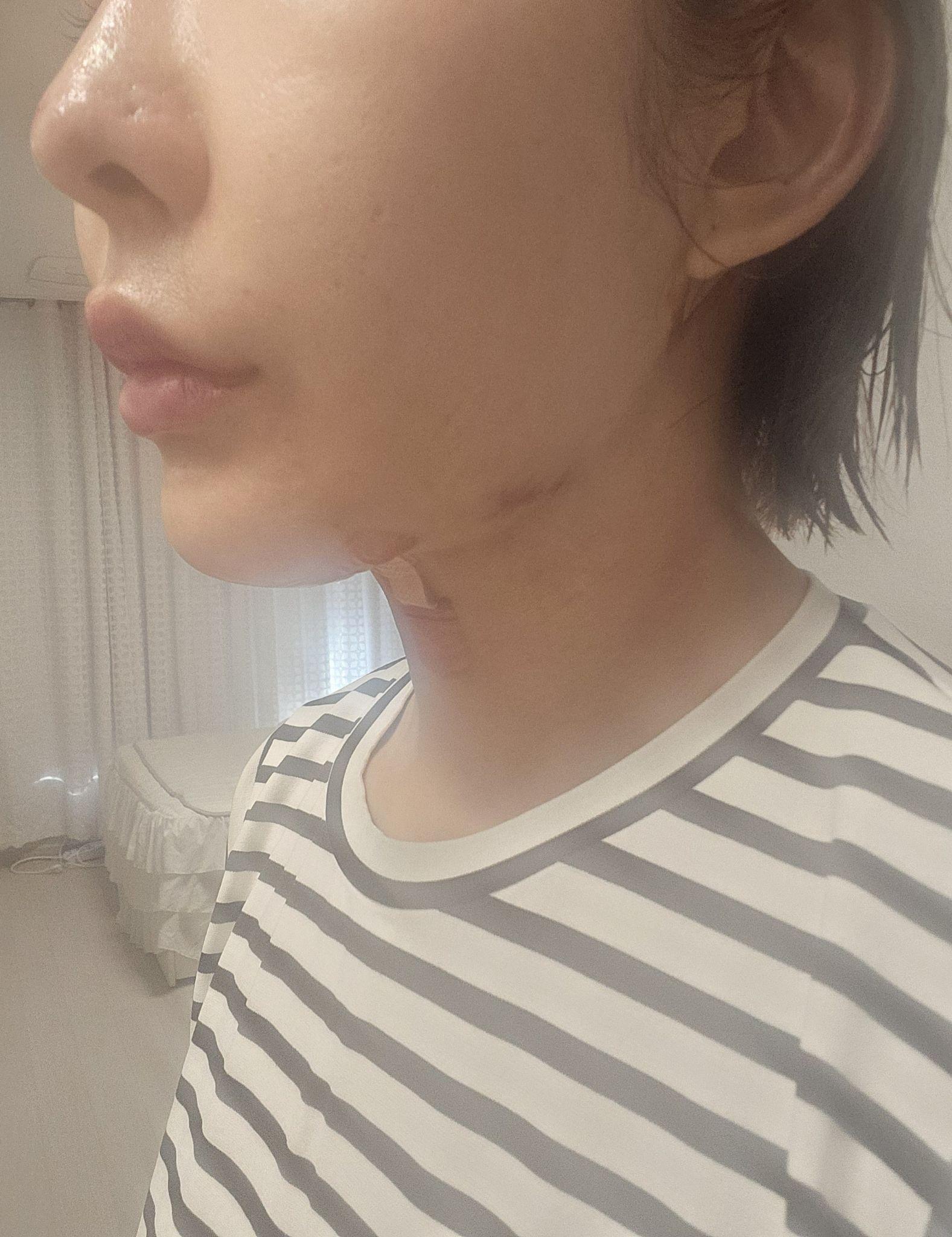 後
