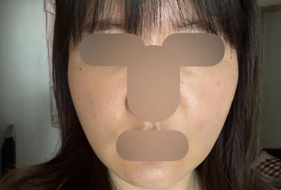 後