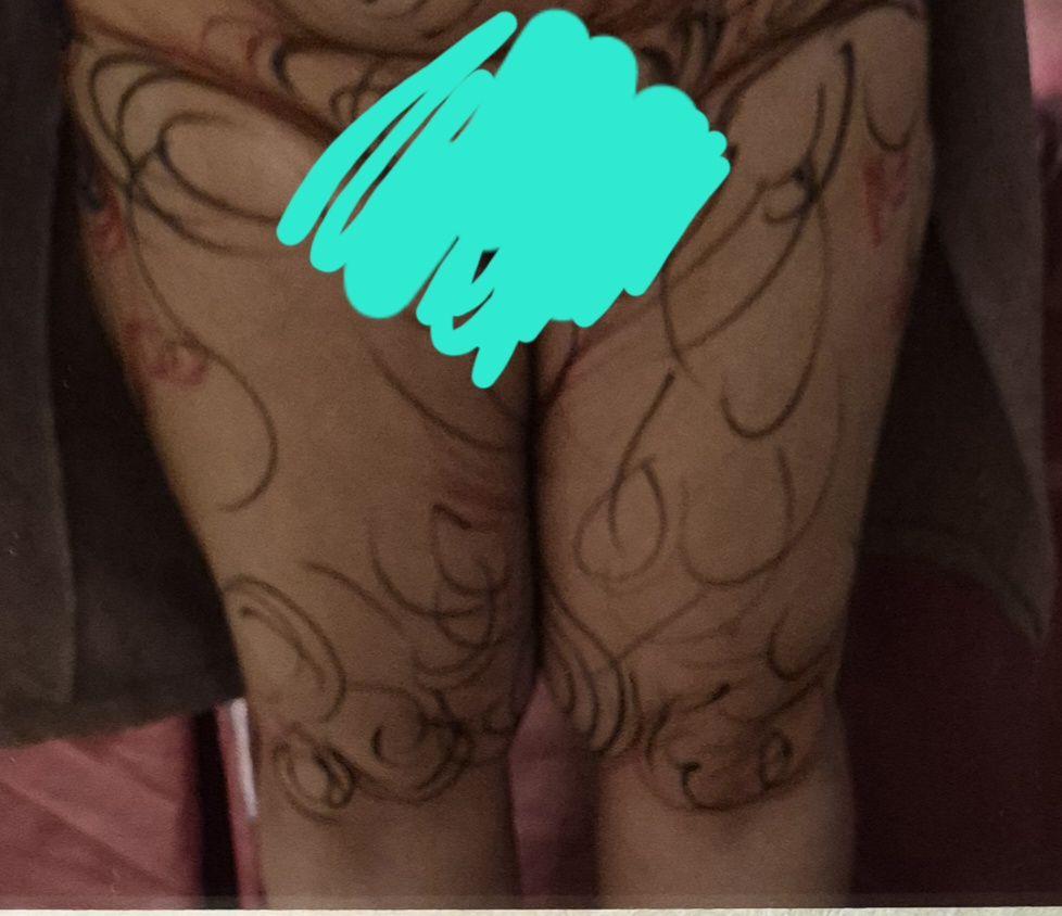 後
