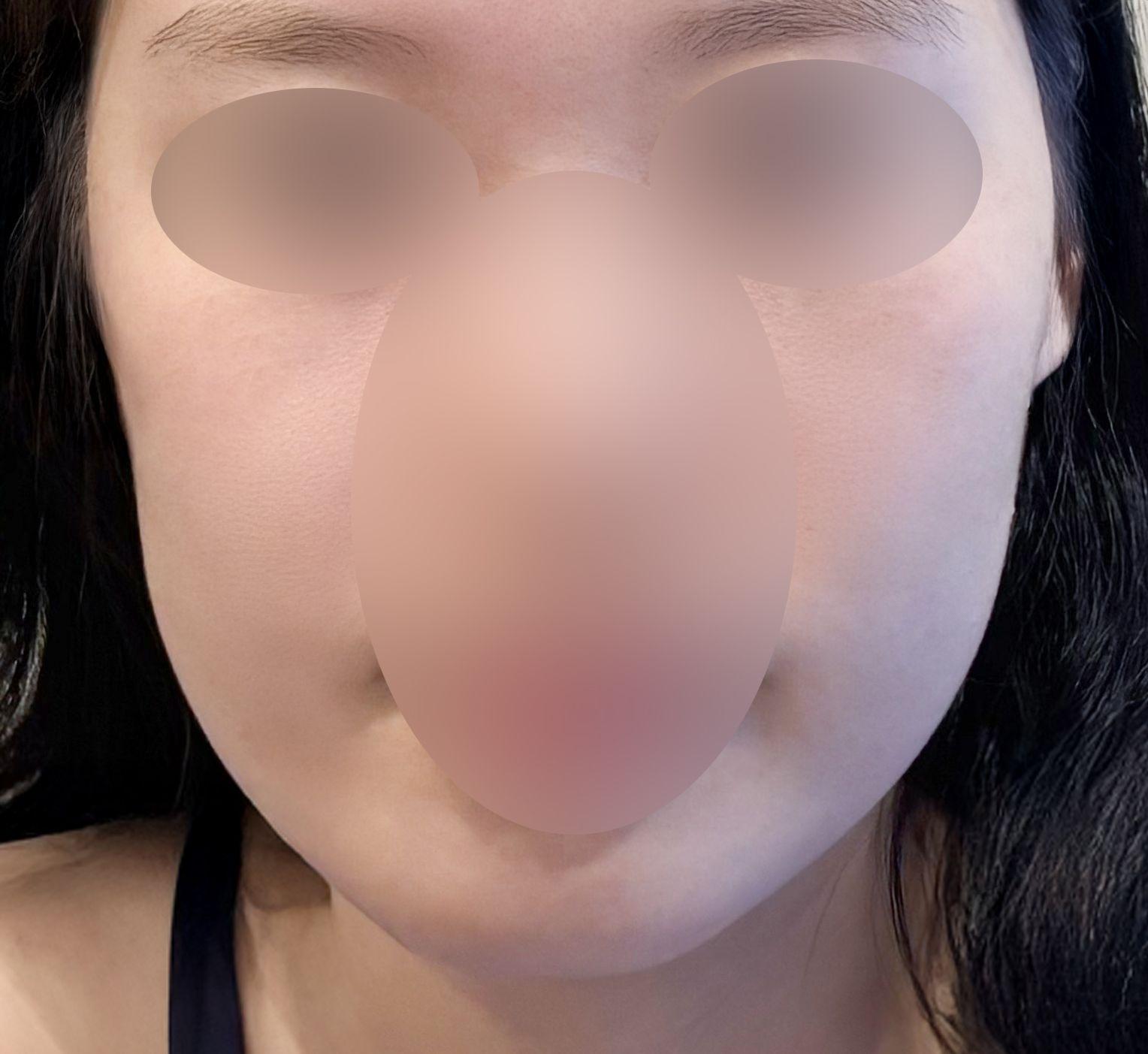 後