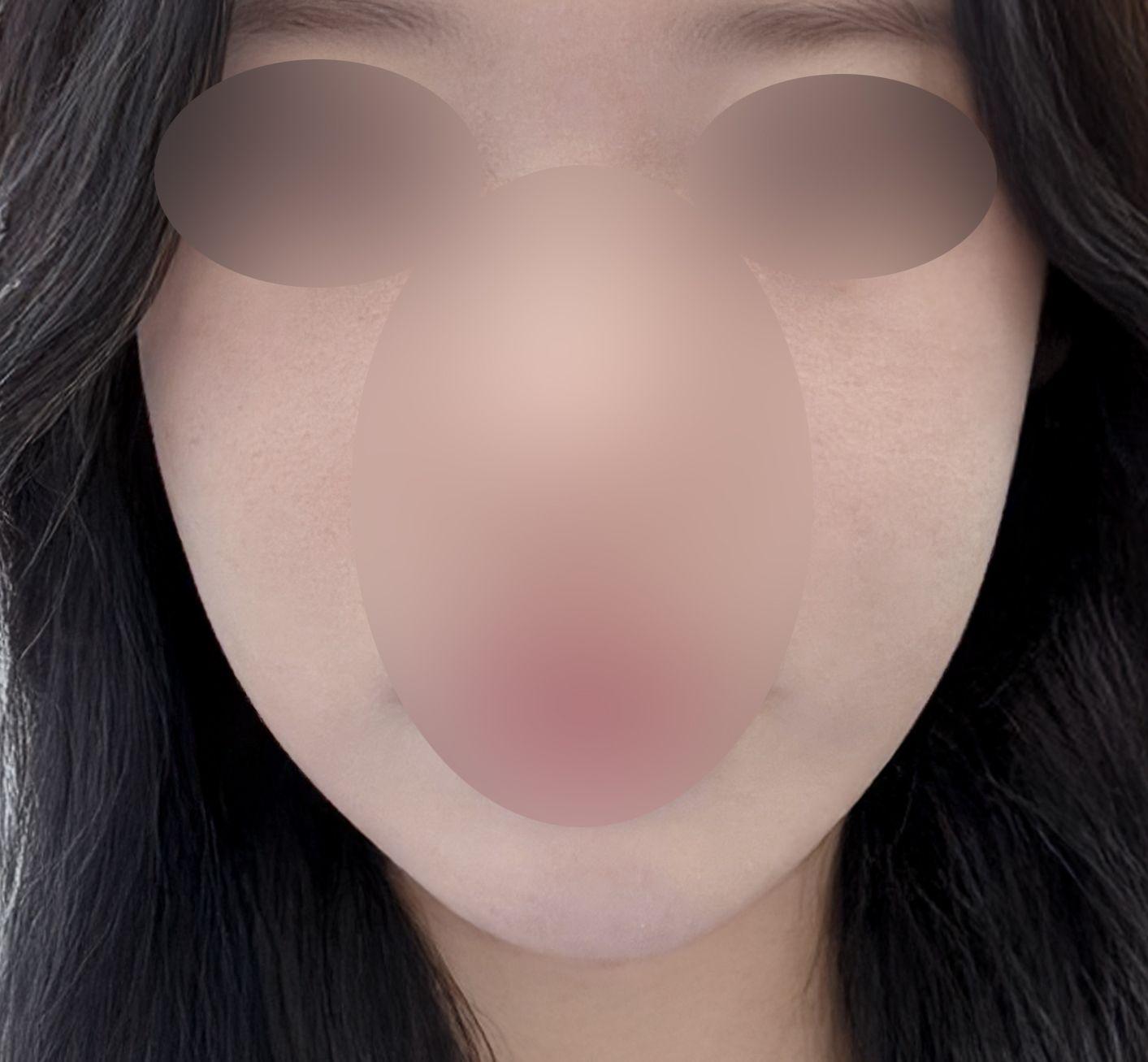 後