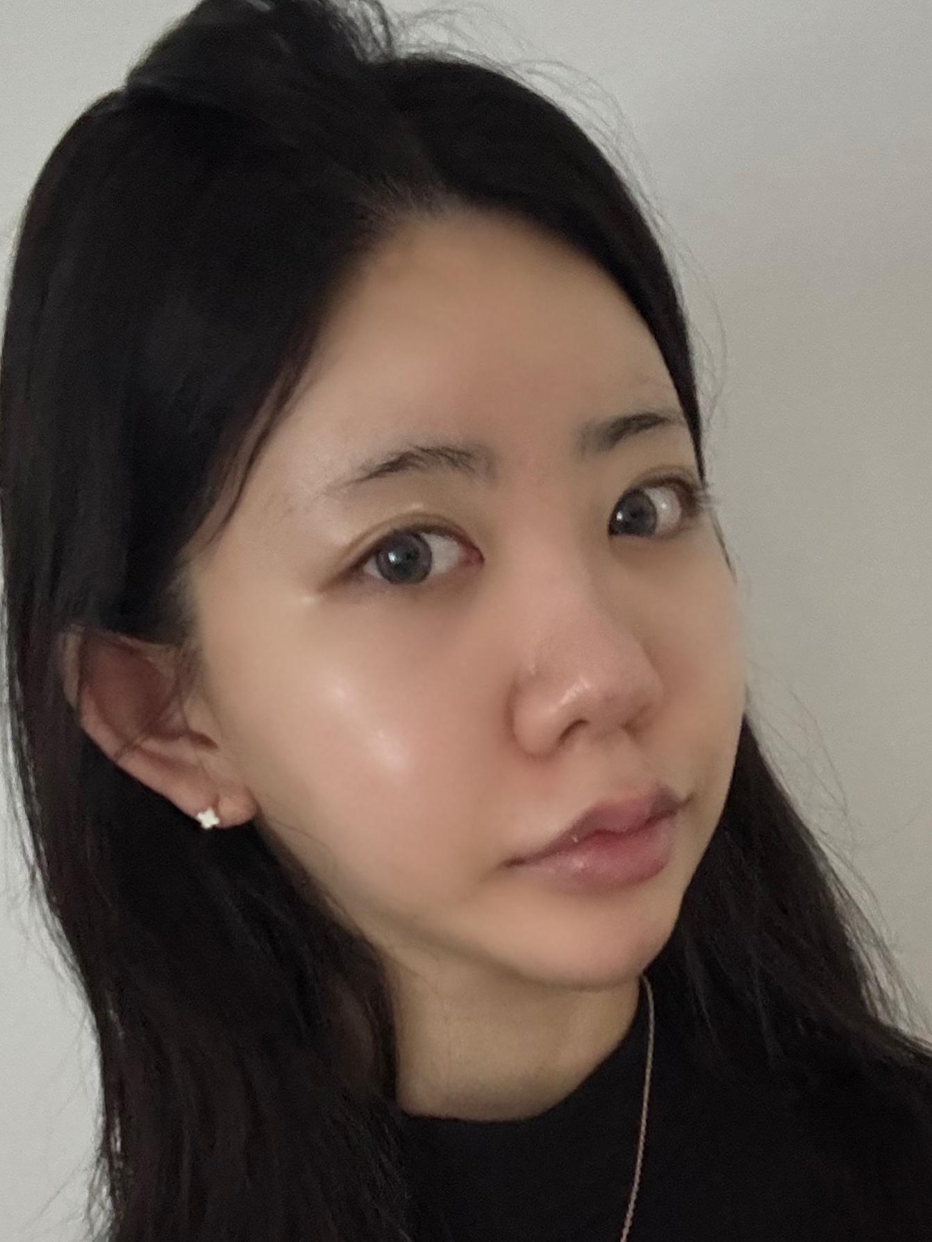 後