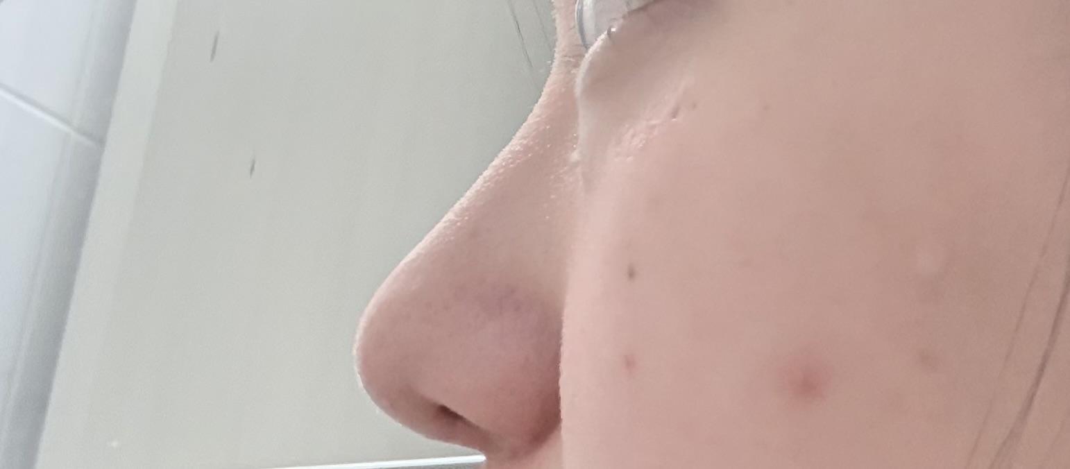 後