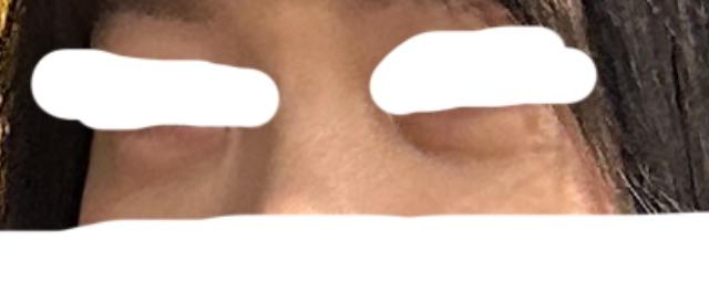 後