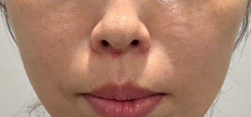 後