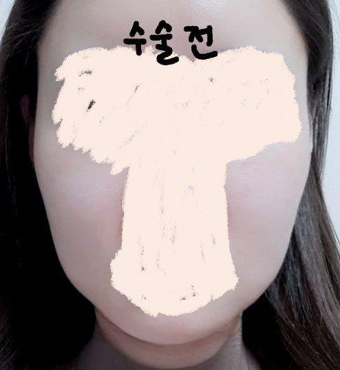 後