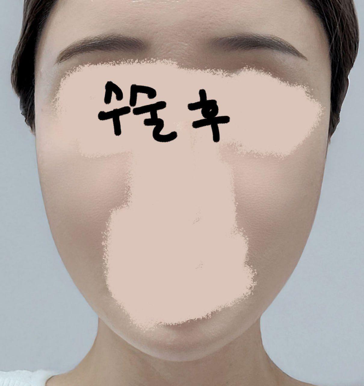 後