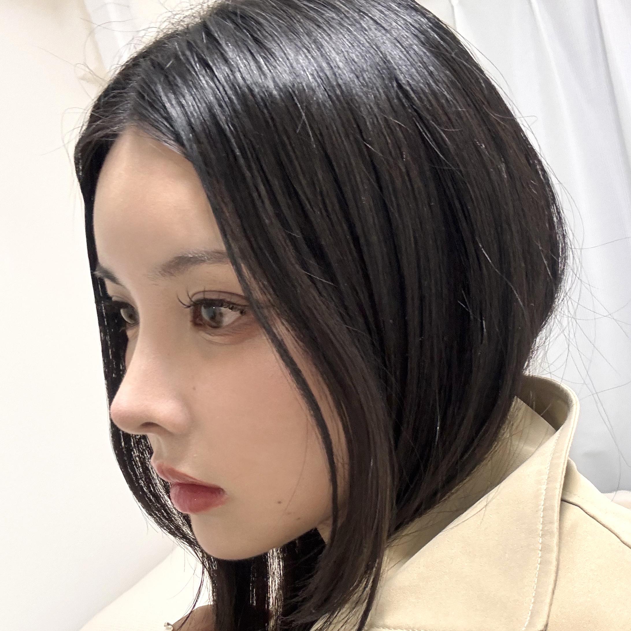 後