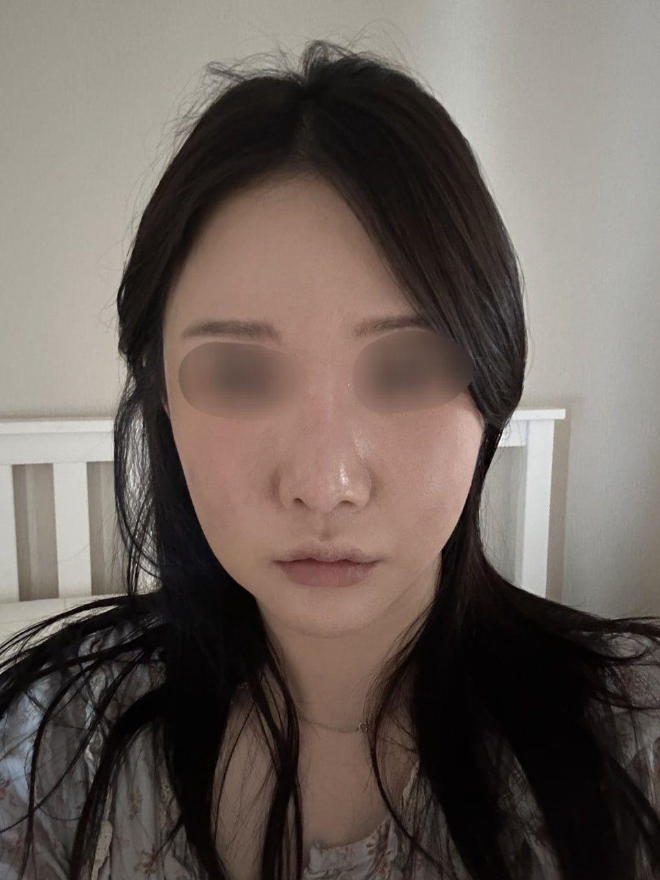 後