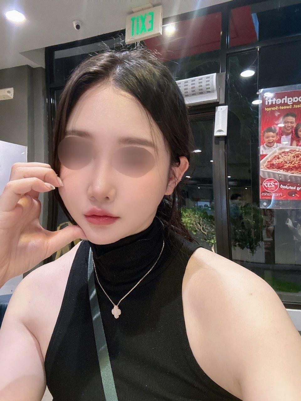後