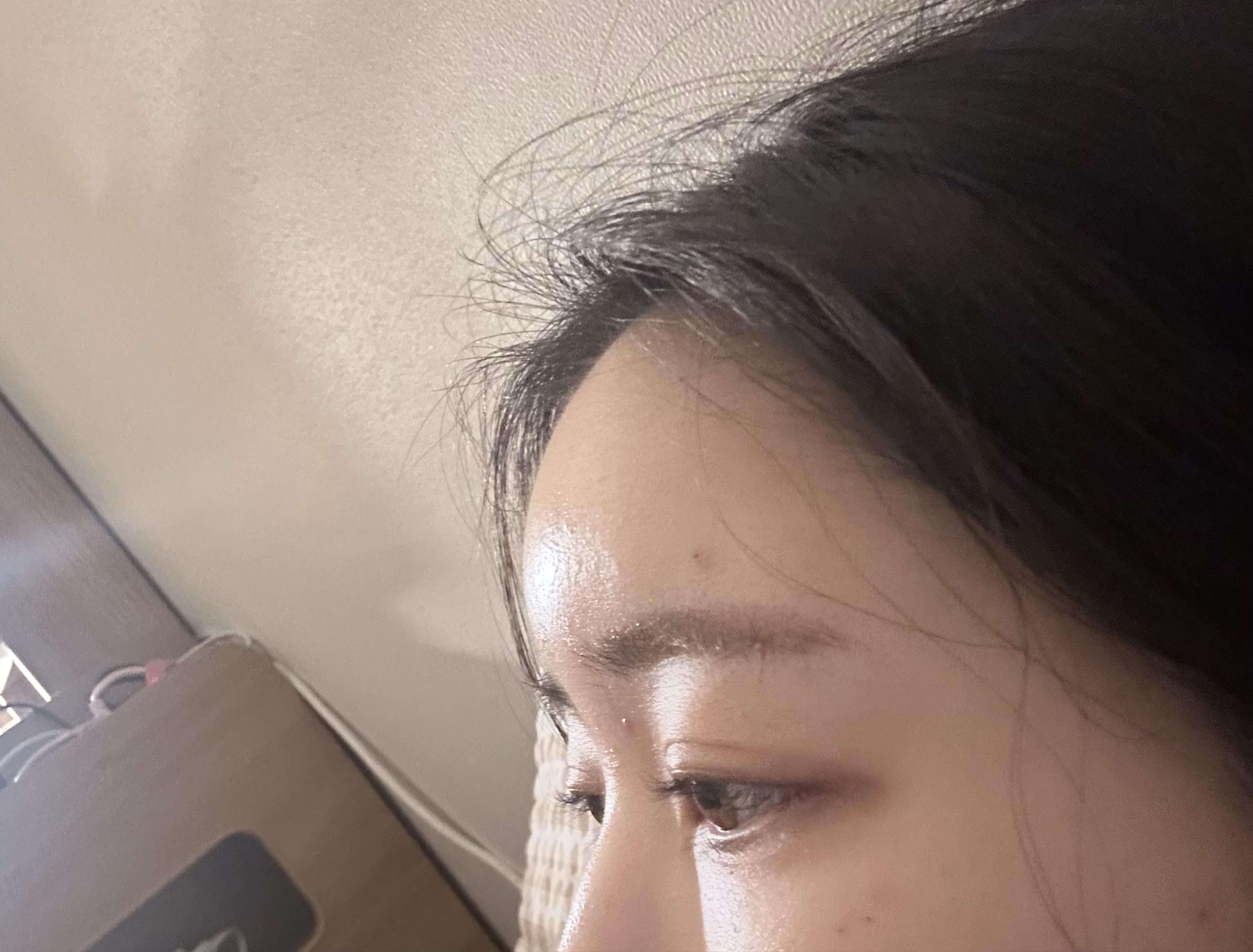 後