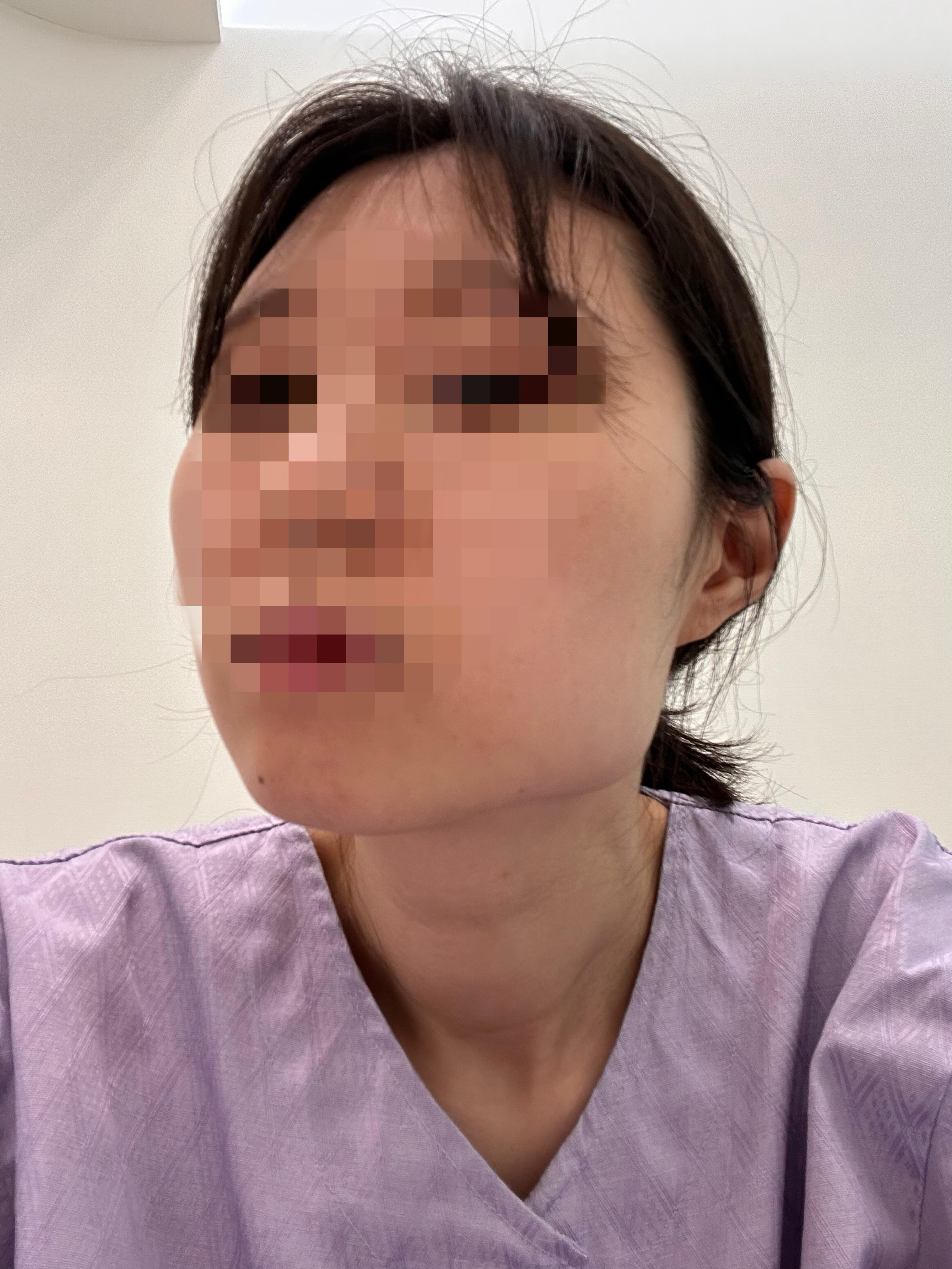 後