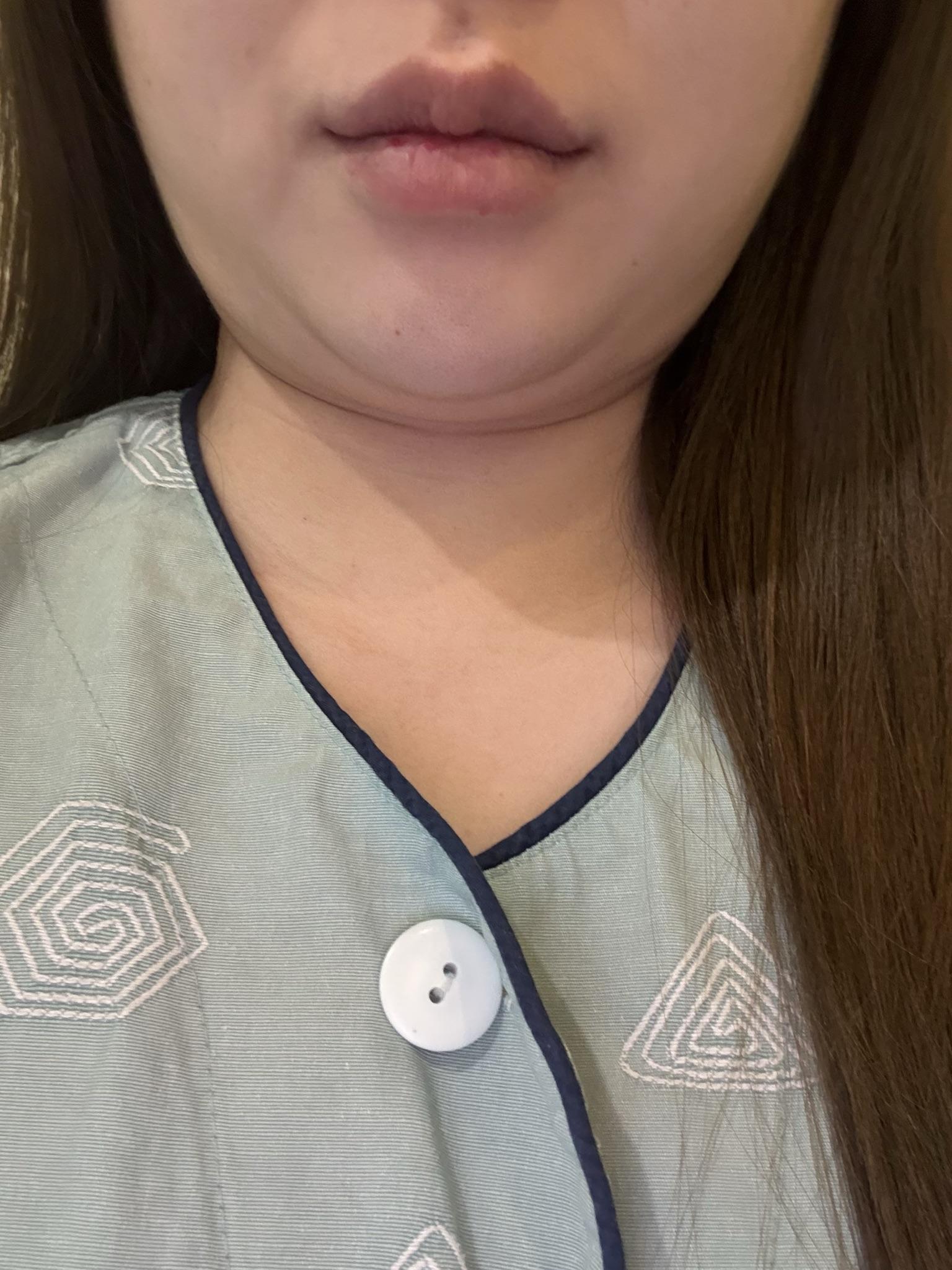 後