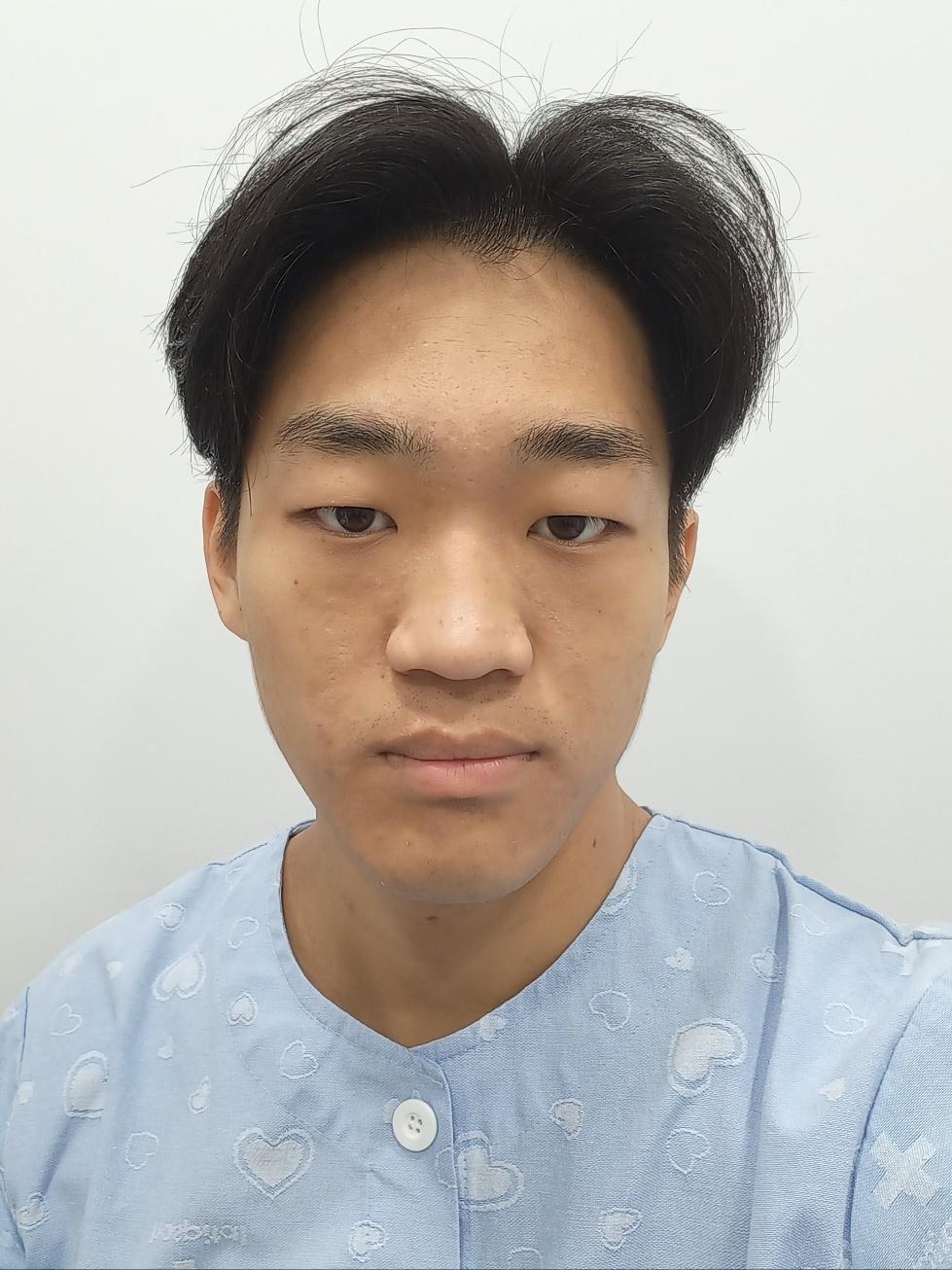 後