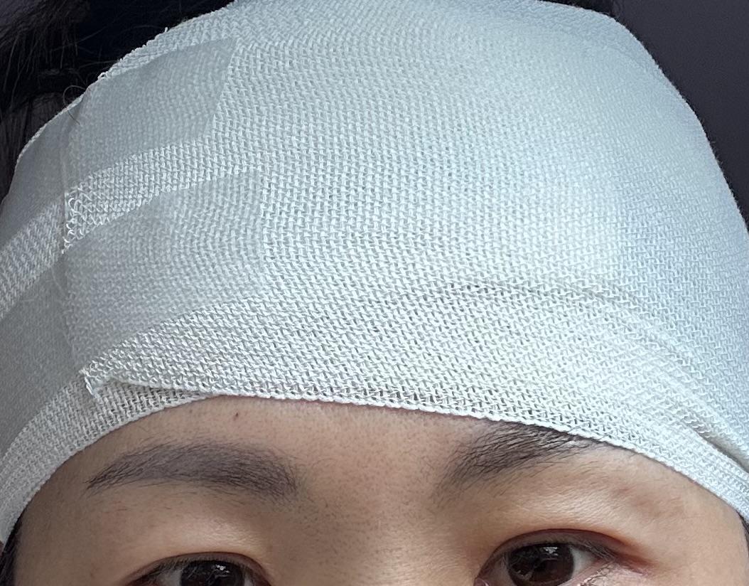 後