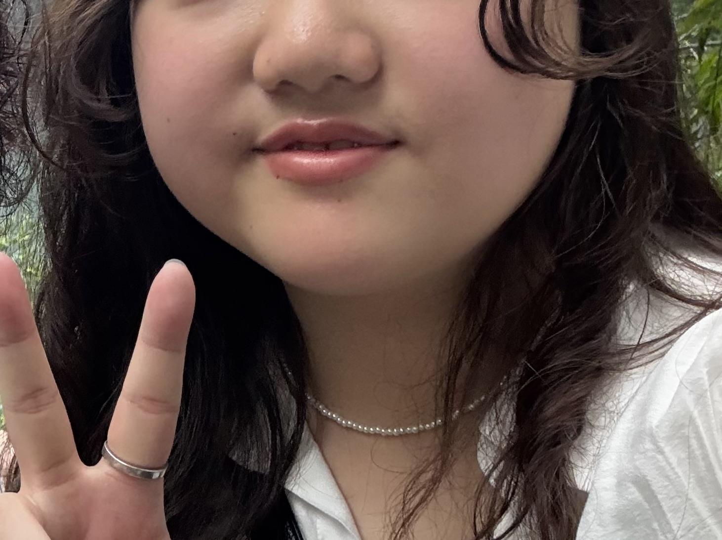 後