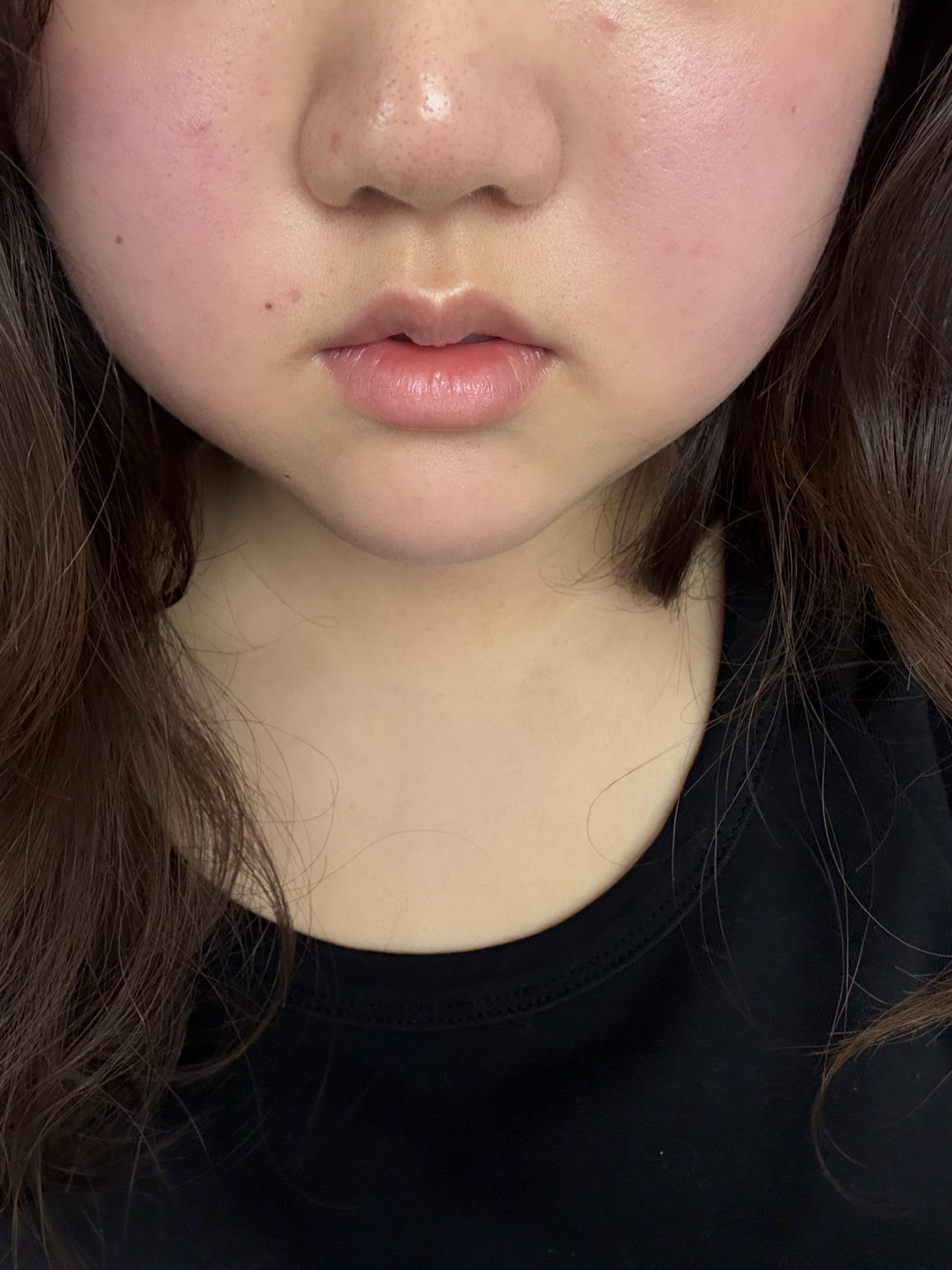 後
