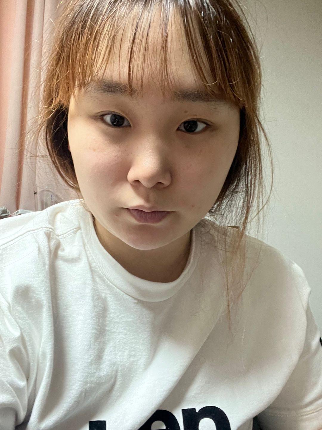 後