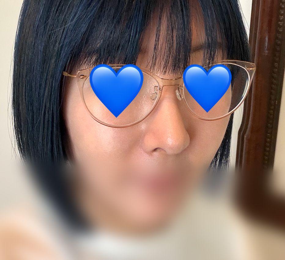 後