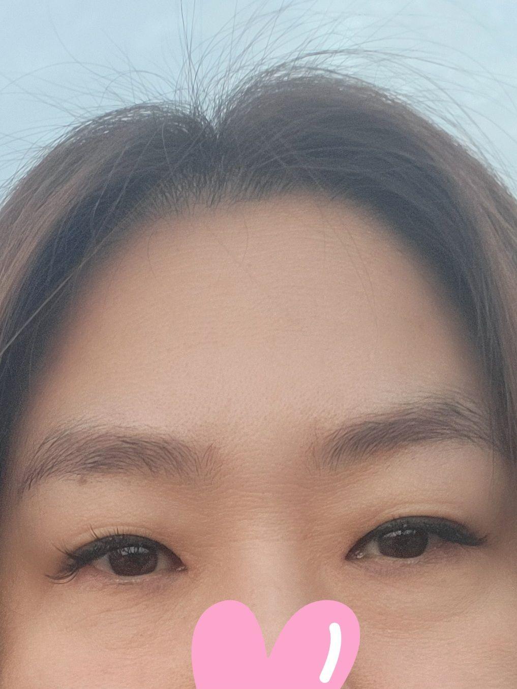 後