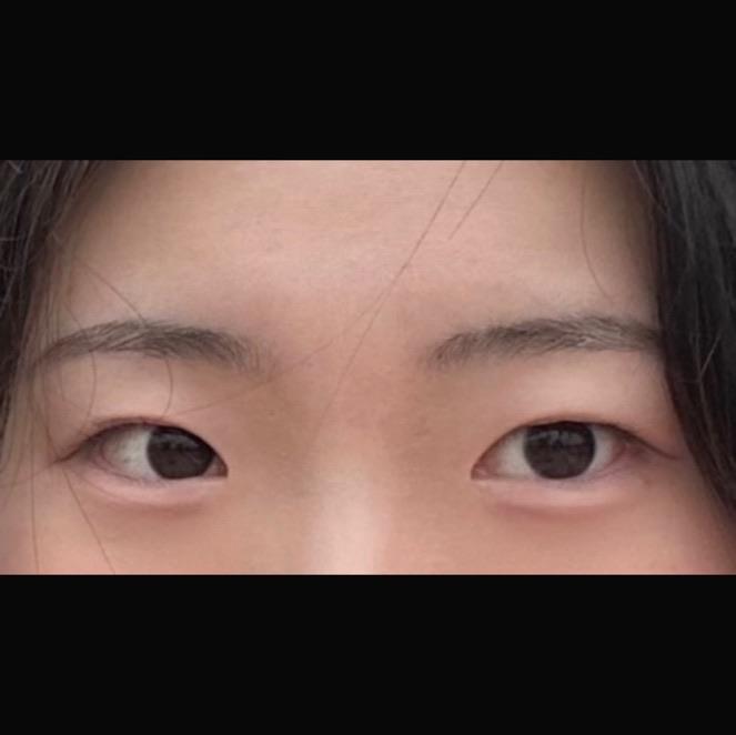 後