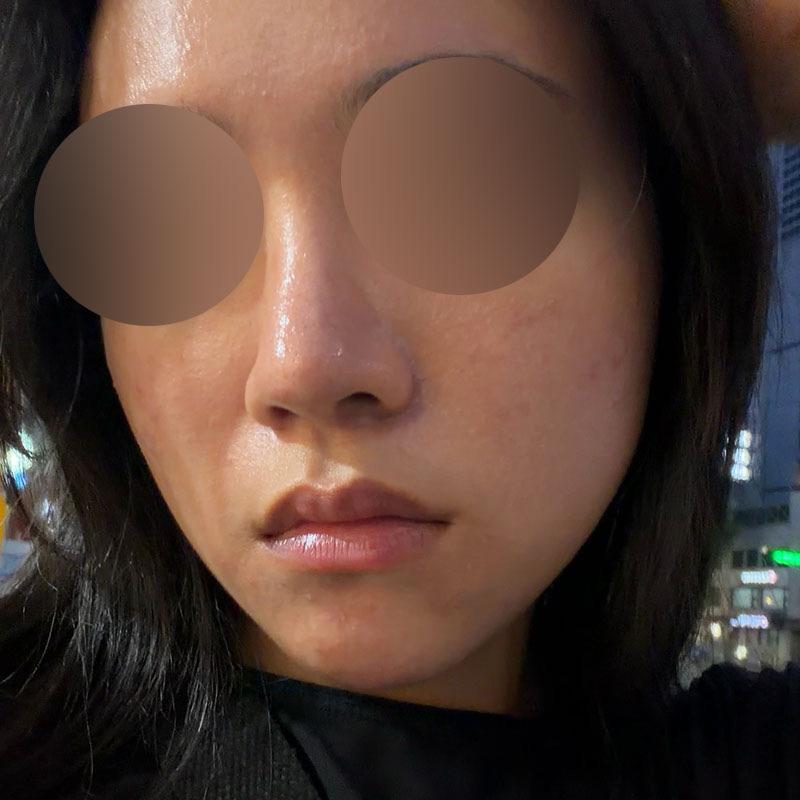 后