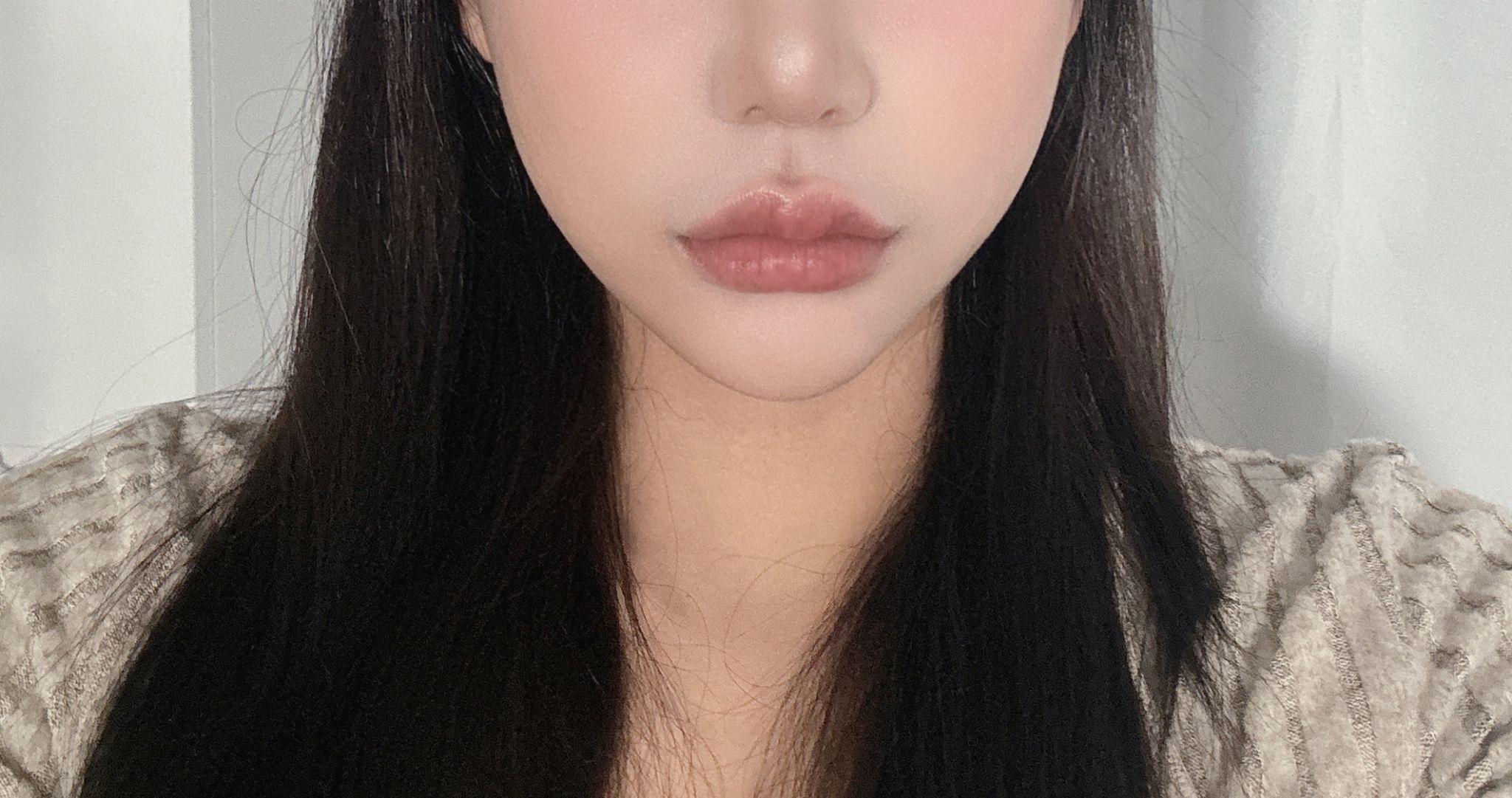 後