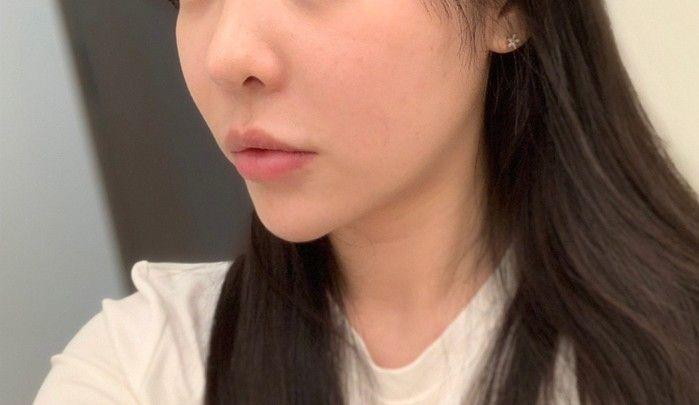 後