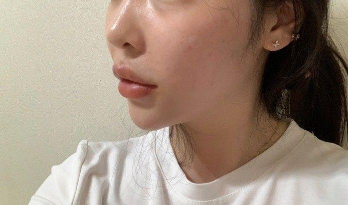 後