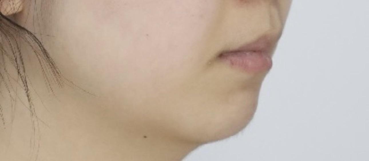 後