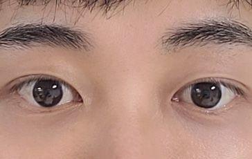 後