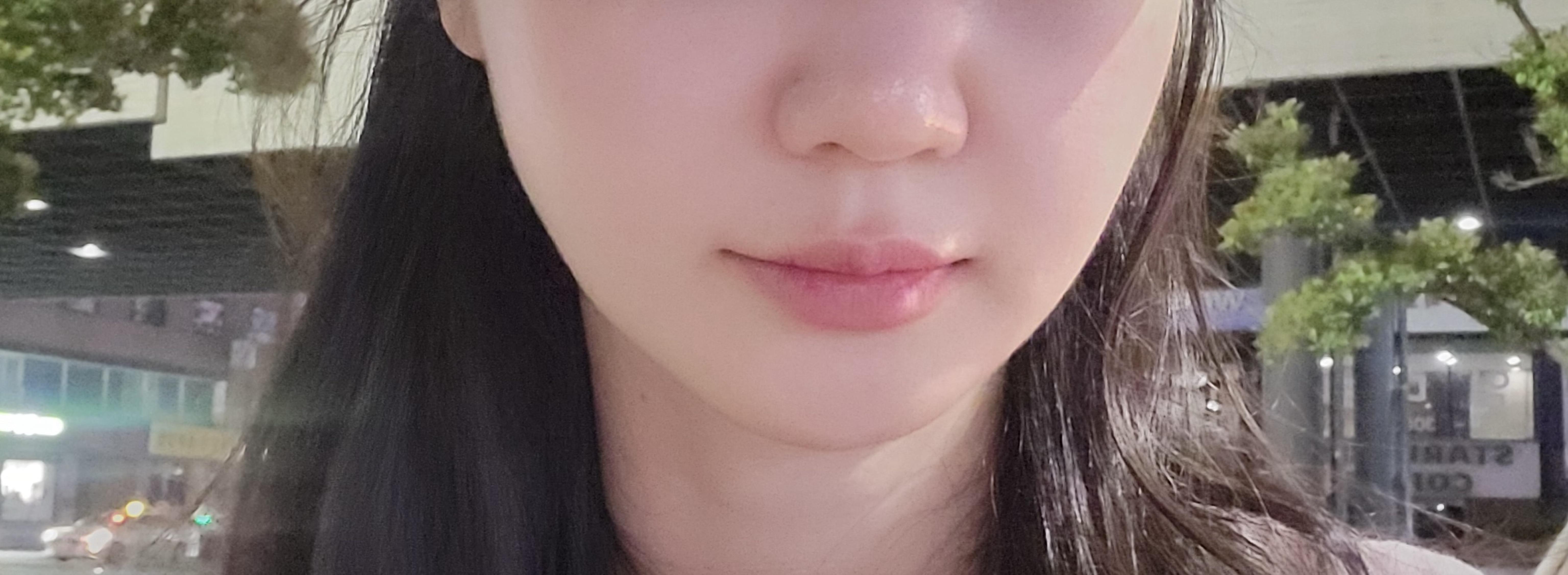 前