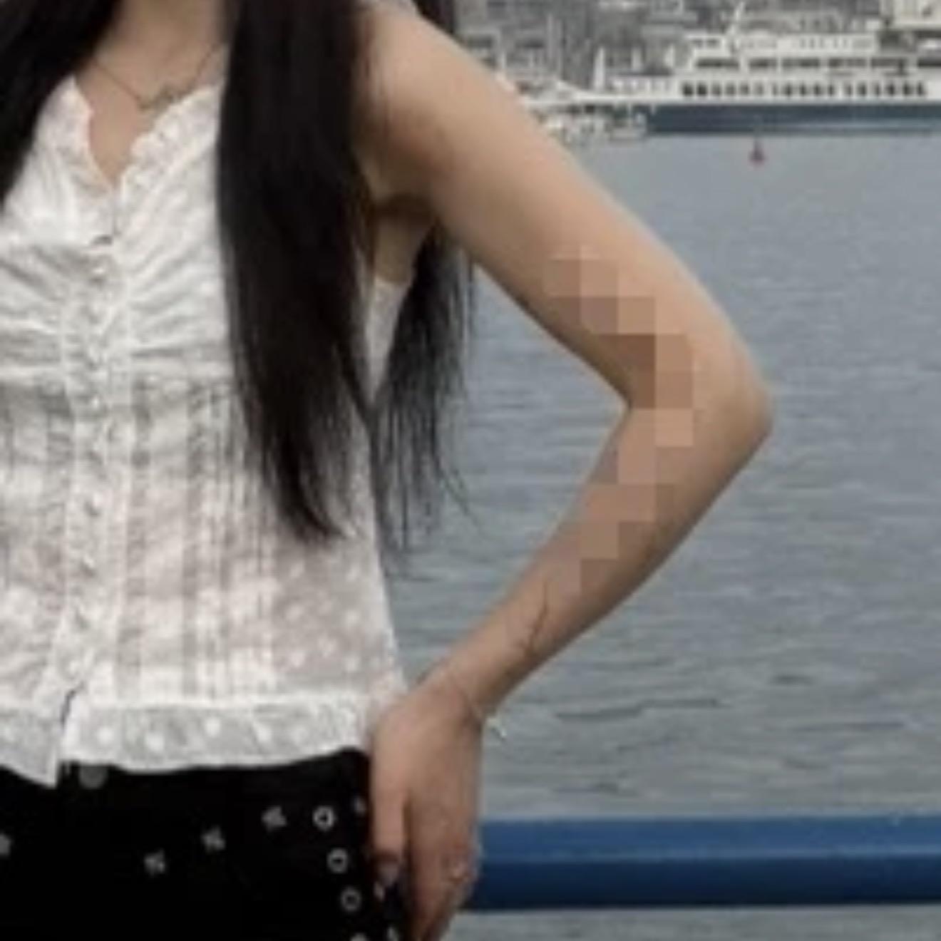 後