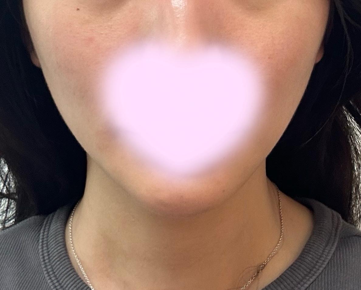 后
