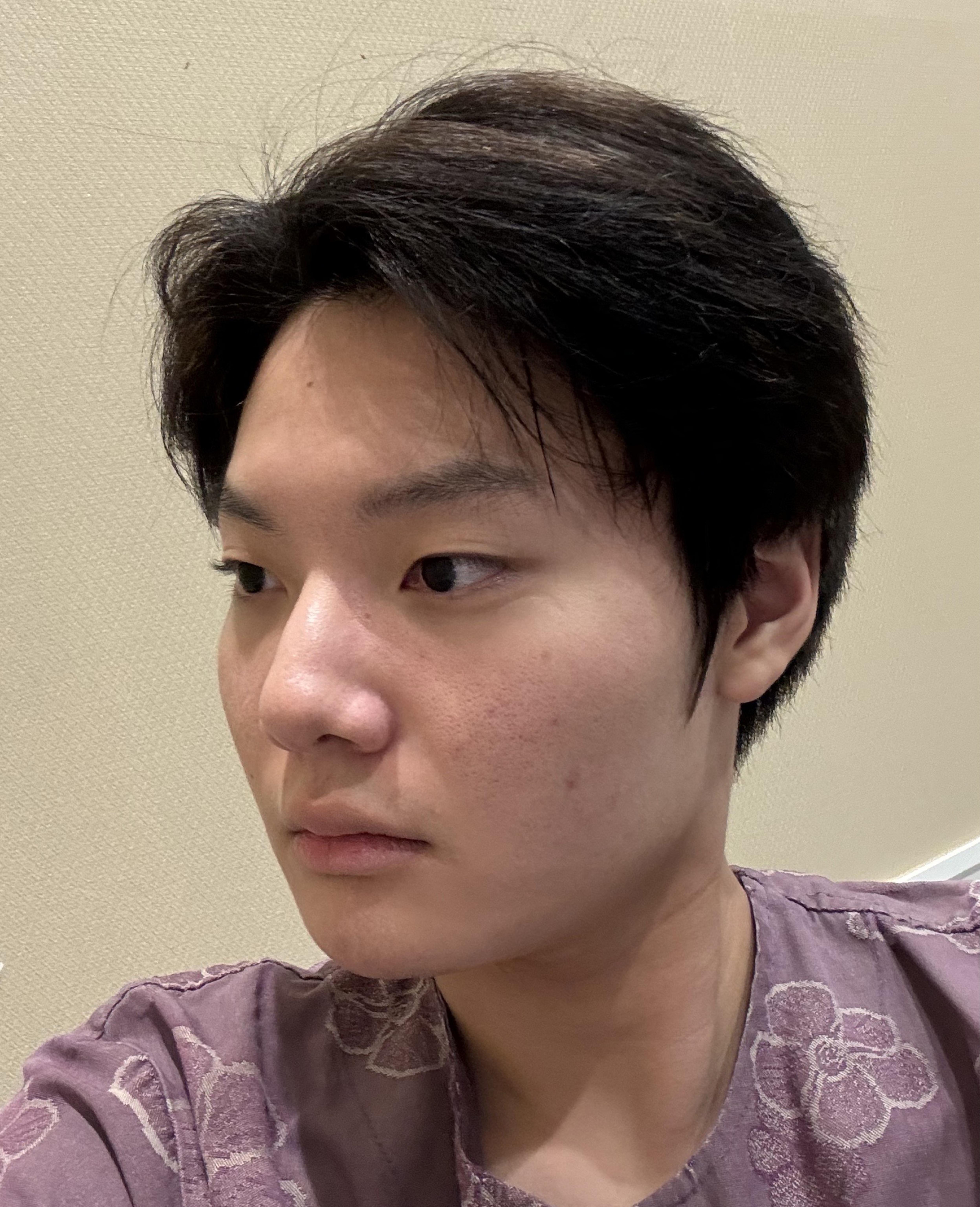 後