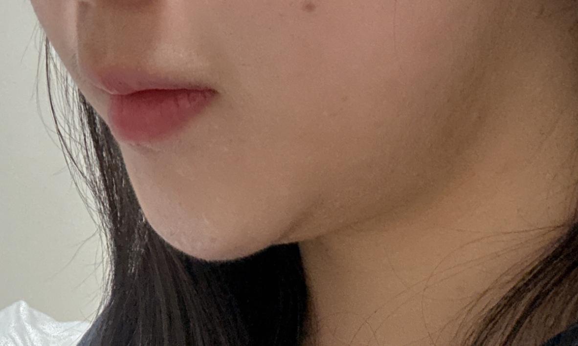 後