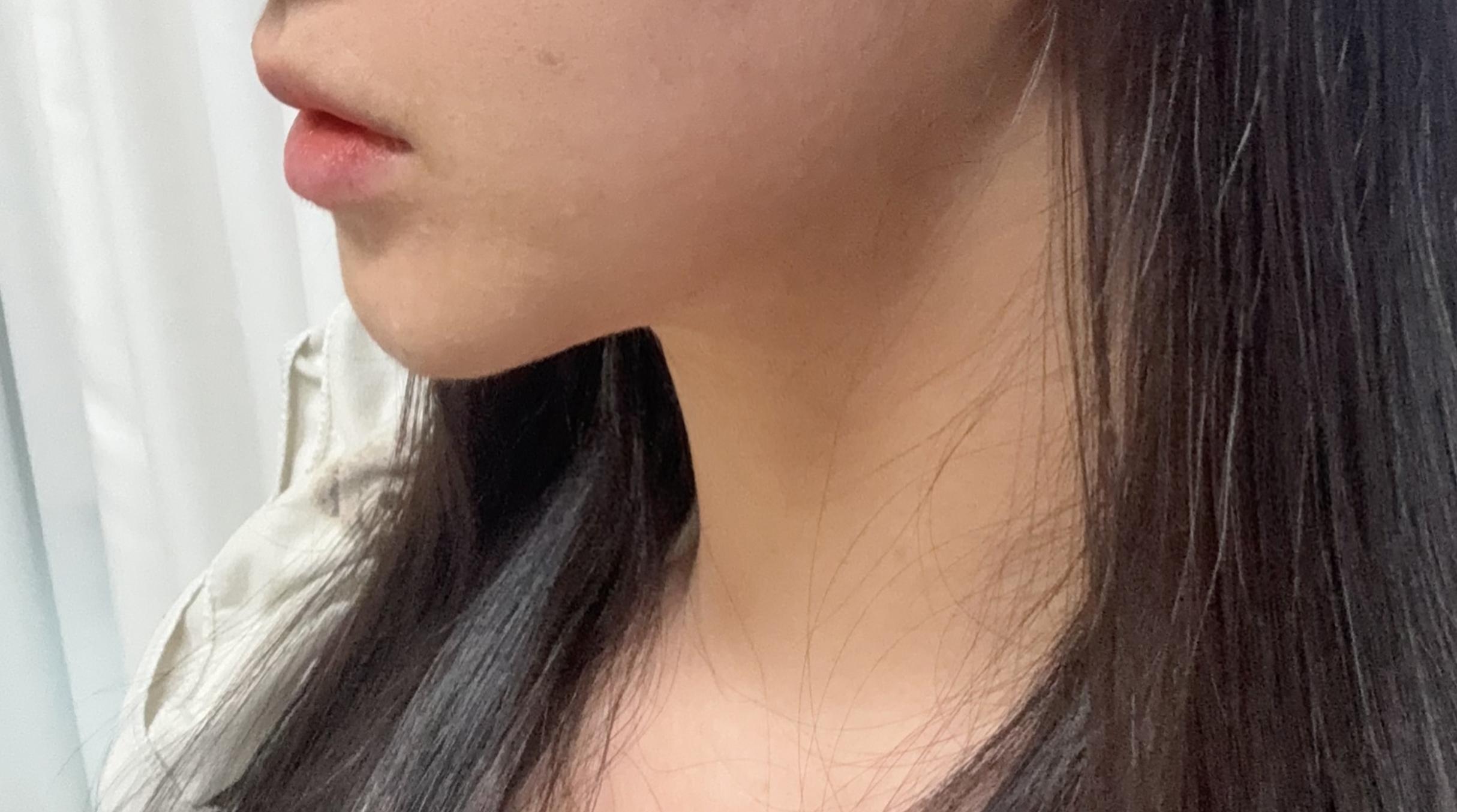 後