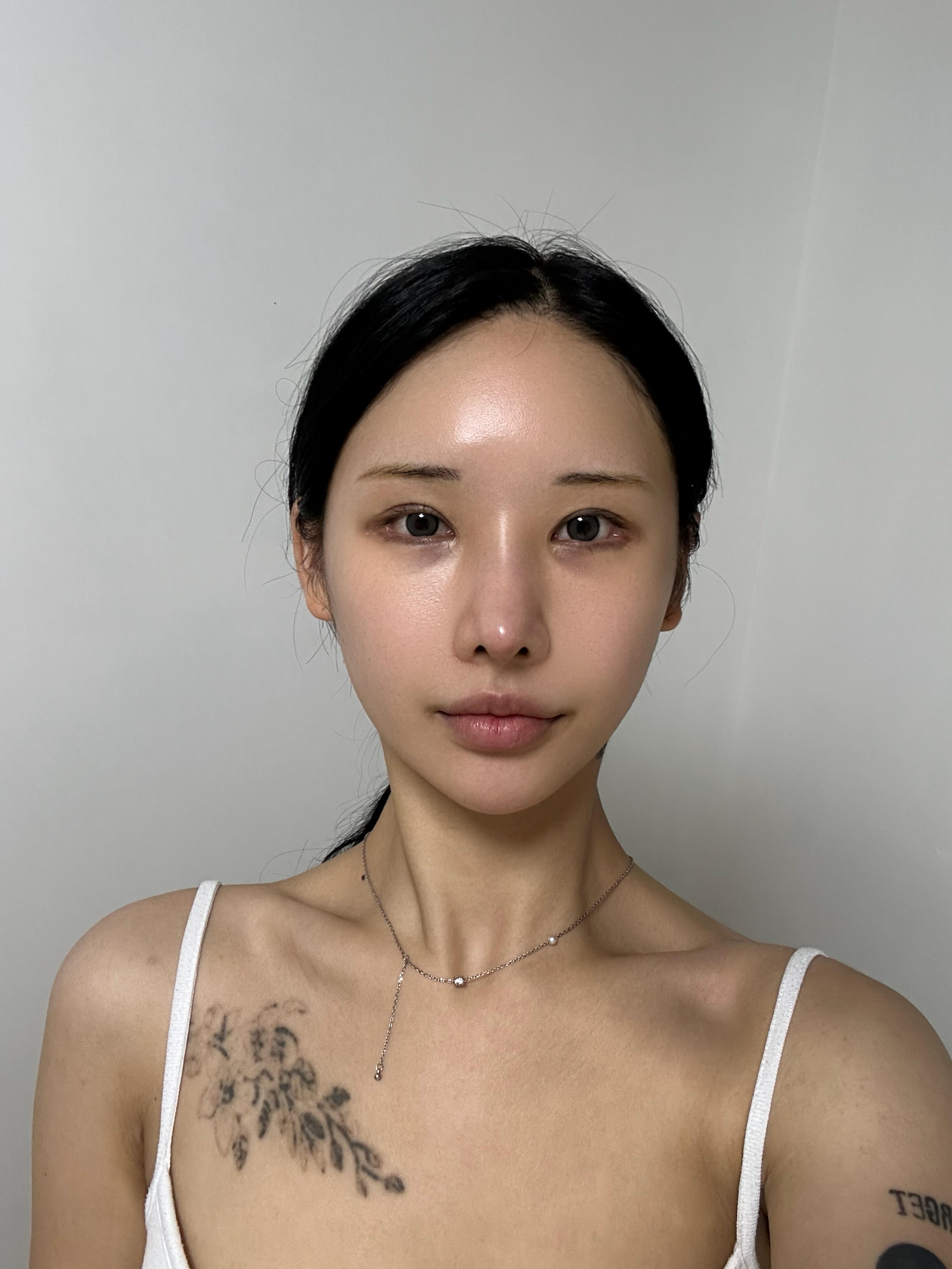 後