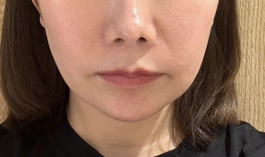 後