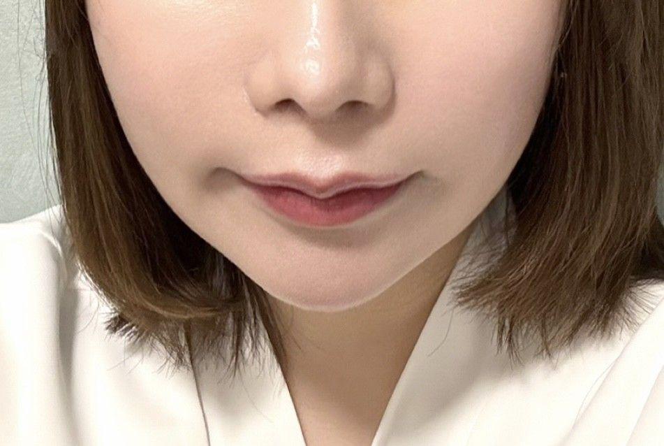 後